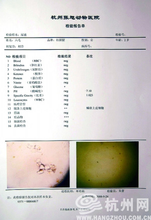 肾结石检查单子图片图片